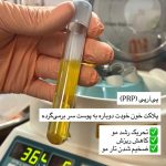 دکتر گیسو کیاور در تبریز
