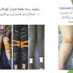 کلینیک ارتوپدی فنی مهر آریا دکتر عاطفه ابوترابی در تهران