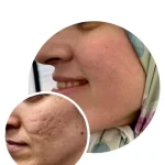 مرکز زیبایی پارسیان رخ در تهران