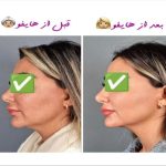مرکز زیبایی پارسیان رخ در تهران