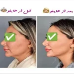 مرکز زیبایی پارسیان رخ در تهران