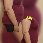 مرکز زیبایی پارسیان رخ در تهران