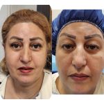 مطب پزشکی زیبایی دکتر رضا جعفری در لاهیجان