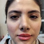 مطب پزشکی زیبایی دکتر رضا جعفری در لاهیجان