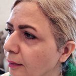 مطب پزشکی زیبایی دکتر رضا جعفری در لاهیجان
