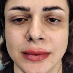 مطب پزشکی زیبایی دکتر رضا جعفری در لاهیجان