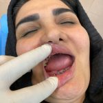 دکتر نبی اله هدایت پور در بابل