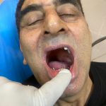 دکتر نبی اله هدایت پور در بابل
