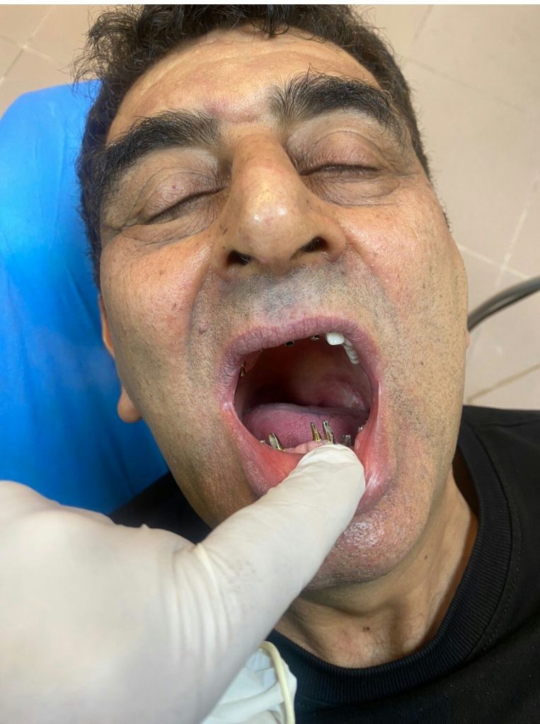 دکتر نبی اله هدایت پور در بابل