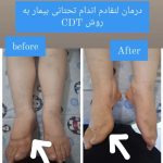 مرکز فیزیوتراپی برتر در گرگان