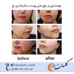 مرکز پوست زیبایی و لیزر دکتر مرتضی دستیار در رشت