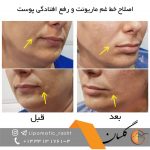 مرکز پوست زیبایی و لیزر دکتر مرتضی دستیار در رشت