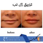 مرکز پوست زیبایی و لیزر دکتر مرتضی دستیار در رشت