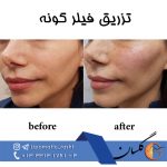 مرکز پوست زیبایی و لیزر دکتر مرتضی دستیار در رشت