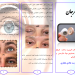 مرکز قالب گیری و ساخت انواع پروتز های چشم مصنوعی مرجان در تهران