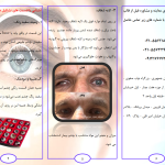 مرکز قالب گیری و ساخت انواع پروتز های چشم مصنوعی مرجان در تهران