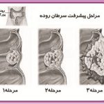 دکتر علی زرگر در قزوین