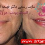 دکتر فهیمه اکبری طامه متخصص زیبایی در ستارخان