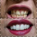 دکتر پریسا پزشک پور در تهران