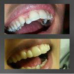 دکتر پریسا پزشک پور در تهران