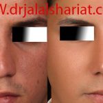 دکتر جلال الدین شریعت در اصفهان