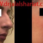 دکتر جلال الدین شریعت در اصفهان