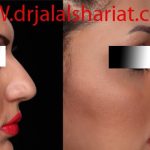 دکتر جلال الدین شریعت در اصفهان