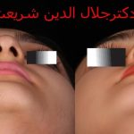 دکتر جلال الدین شریعت در اصفهان