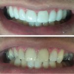 دکتر هدی حسینی در تهران