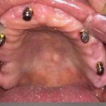 دکتر هدی حسینی در تهران