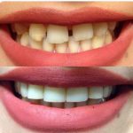 دکتر هدی حسینی در تهران