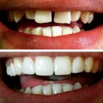 دکتر هدی حسینی در تهران