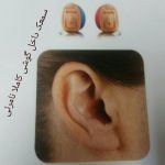 سمعک ولیعصر در تهران