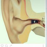 سمعک ولیعصر در تهران