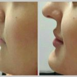 دکتر فرهاد کاوه در کرج