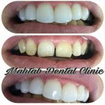 کلینیک دندانپزشکی مهتاب در شیراز