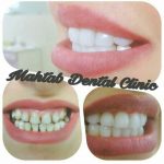 کلینیک دندانپزشکی مهتاب در شیراز