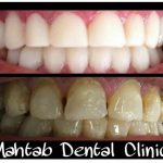 کلینیک دندانپزشکی مهتاب در شیراز