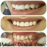 کلینیک دندانپزشکی مهتاب در شیراز