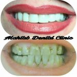 کلینیک دندانپزشکی مهتاب در شیراز