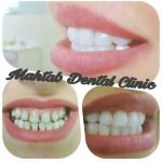 کلینیک دندانپزشکی مهتاب در شیراز