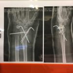 دکتر کیقباد عاشوری در صومعه سرا