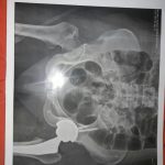 دکتر کیقباد عاشوری در صومعه سرا