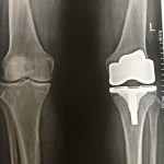 دکتر کیقباد عاشوری در صومعه سرا