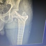 دکتر کیقباد عاشوری در صومعه سرا