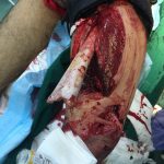 دکتر کیقباد عاشوری در صومعه سرا