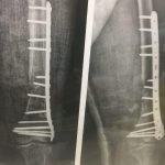 دکتر کیقباد عاشوری در صومعه سرا