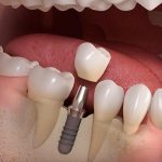 دکتر هدی حسینی در تهران