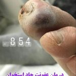 مهدی شهبازی آزاد کارشناس علمی درمان زخم در اصفهان