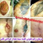 مهدی شهبازی آزاد کارشناس علمی درمان زخم در اصفهان